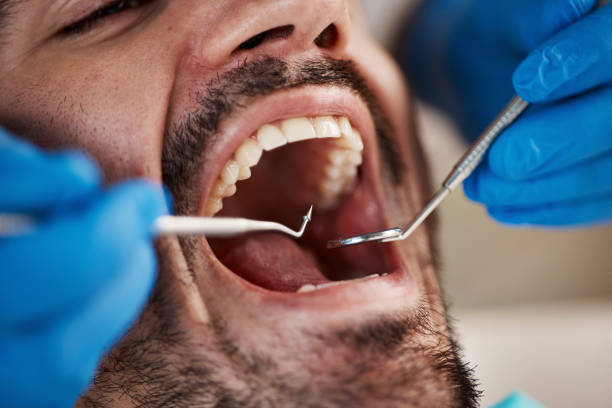 Best Walk-In Emergency Dental Services in East Milton, FL