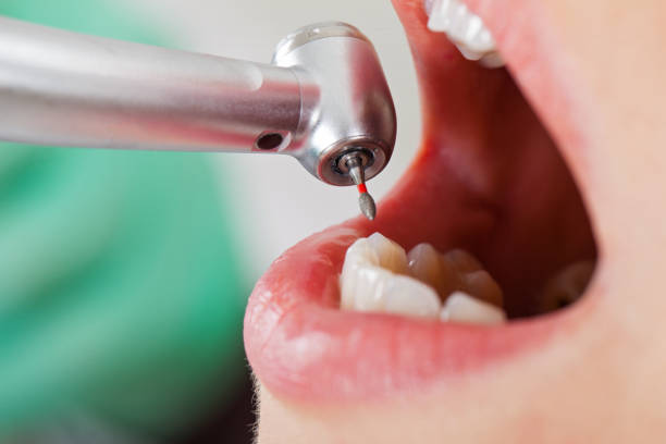 Best Emergency Care for Gum Disease in East Milton, FL